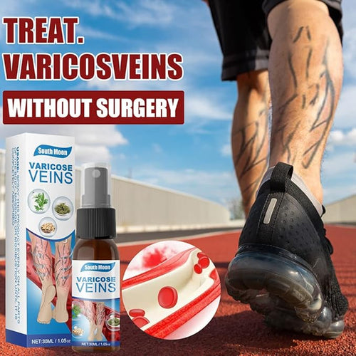 South moon vericose veins spray